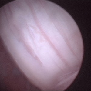 Arthroskopie-5